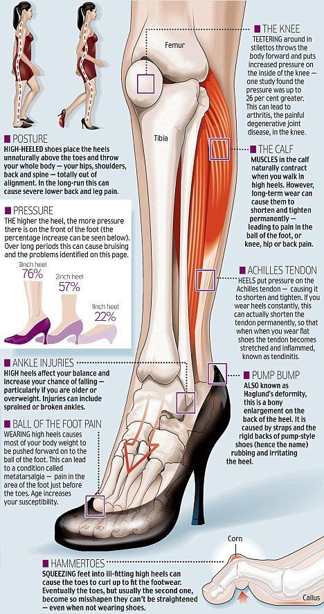 mopo high heels